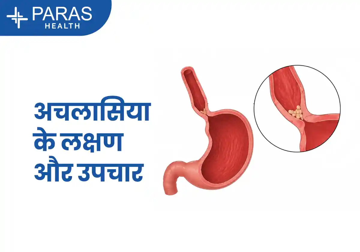 Achalasia (अकलेशिया) क्या है?